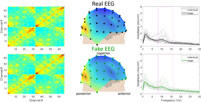Brane Lab - EEG GAN project cover image